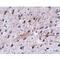 Leucine Rich Repeat And Fibronectin Type III Domain Containing 5 antibody, LS-C108480, Lifespan Biosciences, Immunohistochemistry paraffin image 