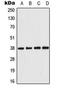 Protein Kinase AMP-Activated Non-Catalytic Subunit Beta 1 antibody, LS-C354056, Lifespan Biosciences, Western Blot image 