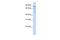 Zinc Finger Protein 699 antibody, A16015, Boster Biological Technology, Western Blot image 