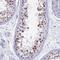 Serine And Arginine Rich Splicing Factor 5 antibody, PA5-60383, Invitrogen Antibodies, Immunohistochemistry paraffin image 