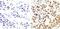 Insulin Receptor Substrate 1 antibody, GTX24873, GeneTex, Immunohistochemistry paraffin image 