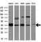 Matrix Metallopeptidase 13 antibody, M00420-1, Boster Biological Technology, Western Blot image 