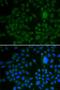 APR antibody, LS-C331470, Lifespan Biosciences, Immunofluorescence image 