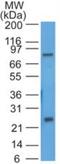 WAP Four-Disulfide Core Domain 2 antibody, NBP2-27299, Novus Biologicals, Western Blot image 