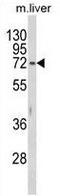 Hexosaminidase Subunit Alpha antibody, GTX81638, GeneTex, Western Blot image 