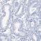 TSPY Like 6 antibody, PA5-57021, Invitrogen Antibodies, Immunohistochemistry frozen image 