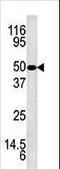 Kallikrein Related Peptidase 5 antibody, LS-C100095, Lifespan Biosciences, Western Blot image 