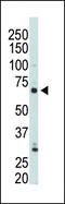 Phosphatidylinositol-4-Phosphate 5-Kinase Type 1 Gamma antibody, 63-358, ProSci, Western Blot image 