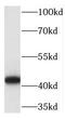 Translocation Associated Membrane Protein 2 antibody, FNab08927, FineTest, Western Blot image 