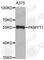 Protein Kinase, Membrane Associated Tyrosine/Threonine 1 antibody, A3654, ABclonal Technology, Western Blot image 