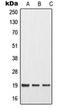 Matrix Metallopeptidase 1 antibody, orb214253, Biorbyt, Western Blot image 