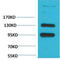 Calcium Voltage-Gated Channel Auxiliary Subunit Alpha2delta 1 antibody, STJ97510, St John