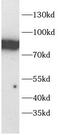 Phosphoinositide-3-Kinase Regulatory Subunit 1 antibody, FNab10724, FineTest, Western Blot image 