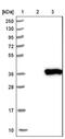 Spermidine Synthase antibody, NBP1-80726, Novus Biologicals, Western Blot image 