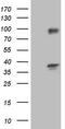 Transforming Acidic Coiled-Coil Containing Protein 2 antibody, CF804275, Origene, Western Blot image 