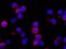 Interferon Alpha And Beta Receptor Subunit 1 antibody, GTX02101, GeneTex, Immunofluorescence image 