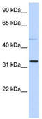 Neuraminidase 4 antibody, TA340248, Origene, Western Blot image 