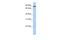 Transmembrane Protein 63A antibody, A14377, Boster Biological Technology, Western Blot image 