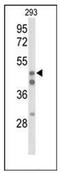 Hepatocyte Nuclear Factor 4 Alpha antibody, AP52067PU-N, Origene, Western Blot image 
