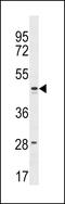 Family With Sequence Similarity 155 Member B antibody, LS-C159600, Lifespan Biosciences, Western Blot image 