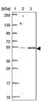 Ring Finger Protein, Transmembrane 2 antibody, PA5-64157, Invitrogen Antibodies, Western Blot image 