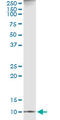 C-X-C Motif Chemokine Ligand 11 antibody, LS-B9948, Lifespan Biosciences, Immunoprecipitation image 