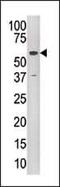 Lysine Acetyltransferase 5 antibody, PA5-11217, Invitrogen Antibodies, Western Blot image 