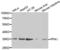 Pyrophosphatase (Inorganic) 1 antibody, LS-C331900, Lifespan Biosciences, Western Blot image 