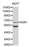 Estrogen Receptor 1 antibody, STJ23574, St John