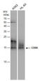 CD59 Molecule (CD59 Blood Group) antibody, GTX130096, GeneTex, Western Blot image 