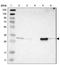 Phospholysine Phosphohistidine Inorganic Pyrophosphate Phosphatase antibody, NBP1-83272, Novus Biologicals, Western Blot image 