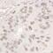 DEAD-Box Helicase 17 antibody, NB200-352, Novus Biologicals, Immunohistochemistry paraffin image 