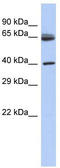 Chimerin 2 antibody, TA339980, Origene, Western Blot image 