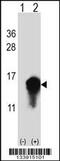 Cystatin A antibody, 57-666, ProSci, Western Blot image 