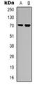 Ribosomal Protein S6 Kinase B1 antibody, LS-C368704, Lifespan Biosciences, Western Blot image 