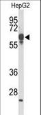 F-Box And Leucine Rich Repeat Protein 5 antibody, LS-C166075, Lifespan Biosciences, Western Blot image 
