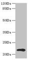 TPD52 Like 1 antibody, LS-C676625, Lifespan Biosciences, Western Blot image 