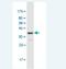 HbA1c antibody, H00003043-M12-100ug, Novus Biologicals, Western Blot image 