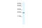 Chloride Intracellular Channel 1 antibody, 28-232, ProSci, Enzyme Linked Immunosorbent Assay image 