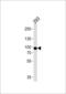 Phospholipase A2 Group IVA antibody, 63-495, ProSci, Western Blot image 