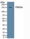 Solute Carrier Family 4 Member 1 (Diego Blood Group) antibody, MBS2028481, MyBioSource, Western Blot image 