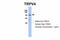 Transient Receptor Potential Cation Channel Subfamily V Member 4 antibody, ARP35416_P050, Aviva Systems Biology, Western Blot image 