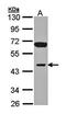 Inositol Polyphosphate-1-Phosphatase antibody, orb73729, Biorbyt, Western Blot image 
