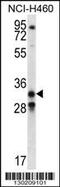 Growth Differentiation Factor 15 antibody, 56-501, ProSci, Western Blot image 