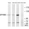 EPH Receptor B6 antibody, A04270, Boster Biological Technology, Western Blot image 