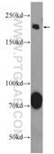 AKAP12 antibody, 25199-1-AP, Proteintech Group, Western Blot image 