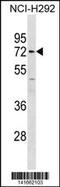 Matrix Metallopeptidase 14 antibody, 60-763, ProSci, Western Blot image 