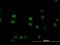 Serum/Glucocorticoid Regulated Kinase 2 antibody, H00010110-M07, Novus Biologicals, Immunocytochemistry image 