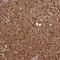 Acid Phosphatase 7, Tartrate Resistant (Putative) antibody, HPA042005, Atlas Antibodies, Immunohistochemistry frozen image 