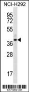 Olfactory Receptor Family 5 Subfamily I Member 1 antibody, 56-634, ProSci, Western Blot image 